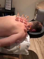 Cupping behandling